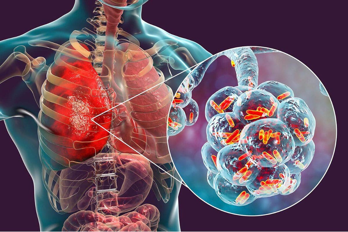 normativa sul trattamento anti legionella
